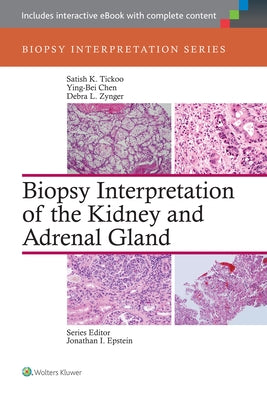 Biopsy Interpretation of the Kidney & Adrenal Gland by Tickoo, Satish