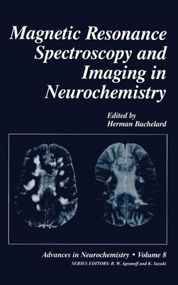 Magnetic Resonance Spectroscopy and Imaging in Neurochemistry by Bachelard, H. S.