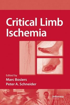 Critical Limb Ischemia by Bosiers, Marc