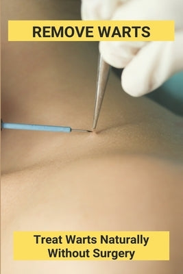 Remove Warts: Treat Warts Naturally Without Surgery: Boost Immune System To Get Rid Of Warts by Anda, Delicia