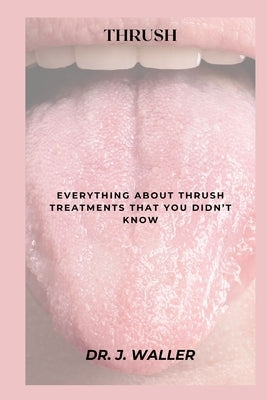 Thrush: Everything about Thrush Treatments That You Didn't Know by Waller, J.