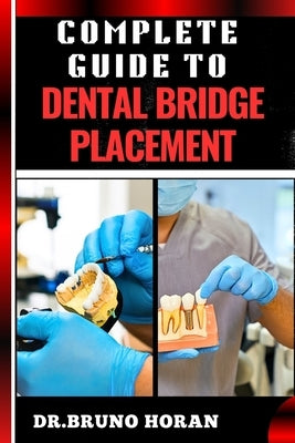Complete Guide to Dental Bridge Placement: Comprehensive Manual To Restoring Smiles, Improving Oral Health, And Ensuring Long Lasting Tooth Solutions by Horan, Bruno