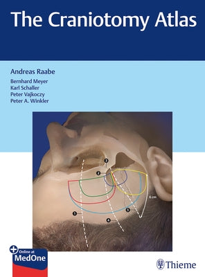 The Craniotomy Atlas by Raabe, Andreas