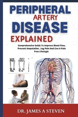 peripheral Artery Disease Explained: Comprehensive Guide To Improve Blood Flow, Prevent Amputation, Leg Pain And Live A Pain Free Lifestyle by Steven, James A.