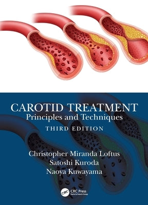 Carotid Treatment: Principles and Techniques by Loftus, Christopher Miranda