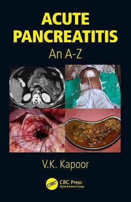 Acute Pancreatitis: An A-Z by Kapoor, V. K.