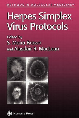 Herpes Simplex Virus Protocols by Brown, S. Moira