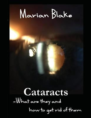 Cataracts: What are they and how to get rid of them? by Blake, Marian