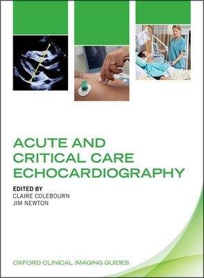 Acute and Critical Care Echocardiography by Colebourn, Claire