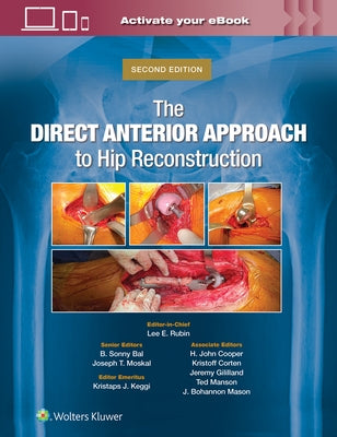 The Direct Anterior Approach to Hip Reconstruction by Rubin, Lee E.