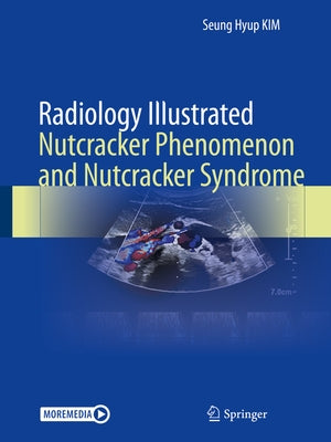 Radiology Illustrated: Nutcracker Phenomenon and Nutcracker Syndrome by Kim, Seung Hyup