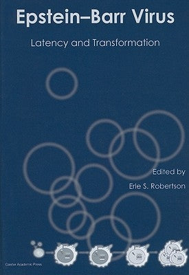 Epstein-Barr Virus: Latency and Transformation by Robertson, Erle S.