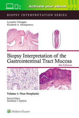 Biopsy Interpretation of the Gastrointestinal Tract Mucosa Volume 1: Non-Neoplastic: Print + eBook with Multimedia Volume 1 by Voltaggio, Lysandra