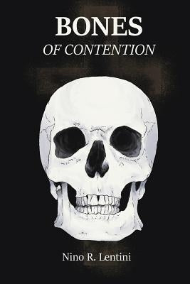 Bones of Contention by Lentini M. D., Nino R.
