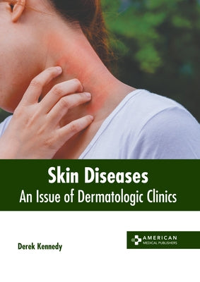 Skin Diseases: An Issue of Dermatologic Clinics by Kennedy, Derek