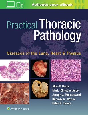 Practical Thoracic Pathology: Diseases of the Lung, Heart, and Thymus by Burke, Allen P.