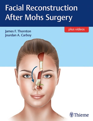 Facial Reconstruction After Mohs Surgery by Thornton, James