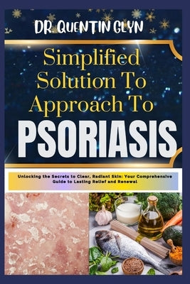 Simplified Solution Approach To PSORIASIS: Unlocking the Secrets to Clear, Radiant Skin: Your Comprehensive Guide to Lasting Relief and Renewal by Glyn, Quentin