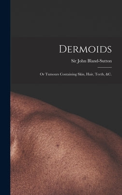 Dermoids: or Tumours Containing Skin, Hair, Teeth, &c. by Bland-Sutton, John