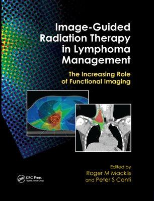 Image-Guided Radiation Therapy in Lymphoma Management: The Increasing Role of Functional Imaging by Macklis, Roger M.
