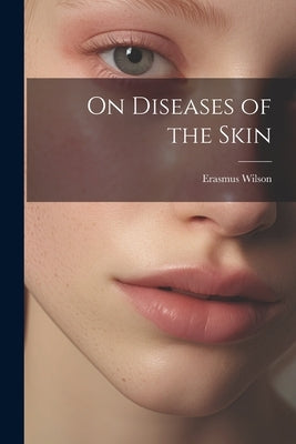 On Diseases of the Skin by Wilson, Erasmus