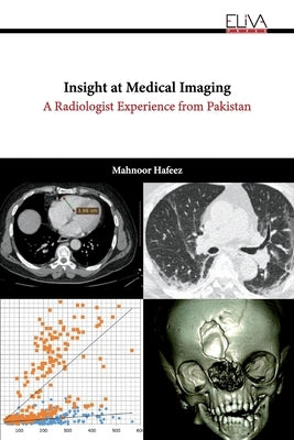 Insight at Medical Imaging: A Radiologist Experience from Pakistan by Hafeez, Mahnoor