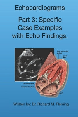 Echocardiograms - Part 3: Specific Case Examples with Echo Findings. by Fleming, Richard M.