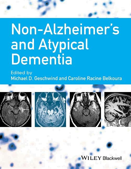 Non-Alzheimer's and Atypical Dementia by Geschwind, Michael D.
