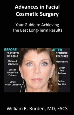 Advances in Facial Cosmetic Surgery: Your Guide to Achieving the Best Long-Term Results by Burden, William R.
