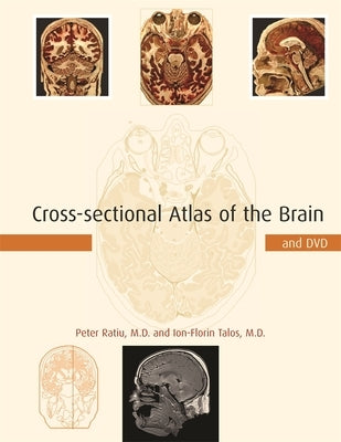 Cross-Sectional Atlas of the Brain and DVD [With DVD-ROM] by Ratiu, Peter