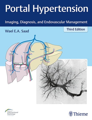 Portal Hypertension: Imaging, Diagnosis, and Endovascular Management by Saad, Wael E. a.