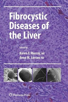 Fibrocystic Diseases of the Liver by Murray, Karen F.