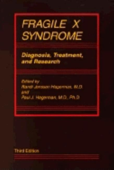 Fragile X Syndrome: Diagnosis, Treatment, and Research by Hagerman, Randi Jenssen