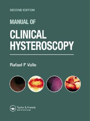 Manual of Clinical Hysteroscopy, Second Edition by Valle, Rafael F.