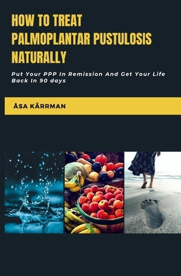 How To Treat Palmoplantar Pustulosis Naturally: Put Your PPP In Remission And Get Your Life Back! by Kärrman, Åsa