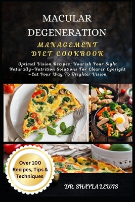 Macular Degeneration Management Diet Cookbook: Optimal Vision Recipes: Nourish Your Sight Naturally-Nutrition Solutions For Clearer Eyesight -Eat Your by Lewis, Shayla