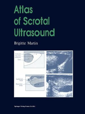 Atlas of Scrotal Ultrasound by Martin, Brigitte
