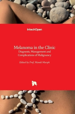 Melanoma in the Clinic: Diagnosis, Management and Complications of Malignancy by Murph, Mandi