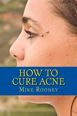 How To Cure Acne: What Is Acne And The Best Treatments For Acne by Rooney, Mike