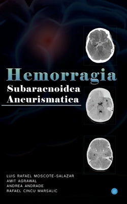 Hemorragia Subaracnoidea Aneurismatica by Agrawal, Amit