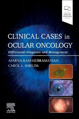 Clinical Cases in Ocular Oncology: Differential Diagnosis and Management by Ramasubramanian, Aparna