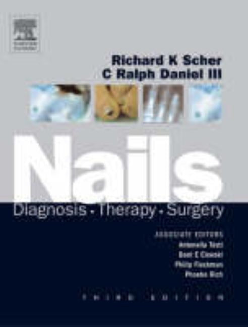 Nails: Diagnosis, Therapy, Surgery by Scher, Richard K.