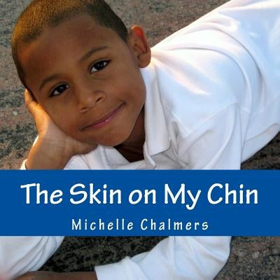 The Skin on My Chin by Chalmers, Michelle