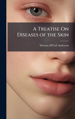 A Treatise On Diseases of the Skin by Anderson, Thomas m'Call