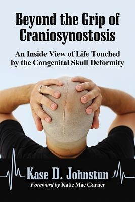 Beyond the Grip of Craniosynostosis: An Inside View of Life Touched by the Congenital Skull Deformity by Johnstun, Kase D.