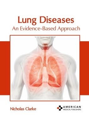 Lung Diseases: An Evidence-Based Approach by Clarke, Nicholas