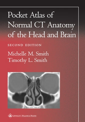 Pocket Atlas of Normal CT Anatomy of the Head and Brain by Smith, Michelle M.