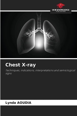 Chest X-ray by Aoudia, Lynda