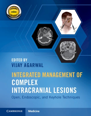 Integrated Management of Complex Intracranial Lesions Hardback Set and Static Online Product: Open, Endoscopic, and Keyhole Techniques by Agarwal, Vijay