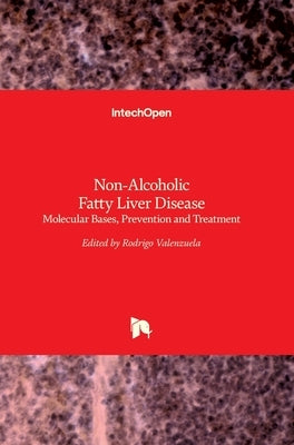 Non-Alcoholic Fatty Liver Disease: Molecular Bases, Prevention and Treatment by Valenzuela Baez, Rodrigo